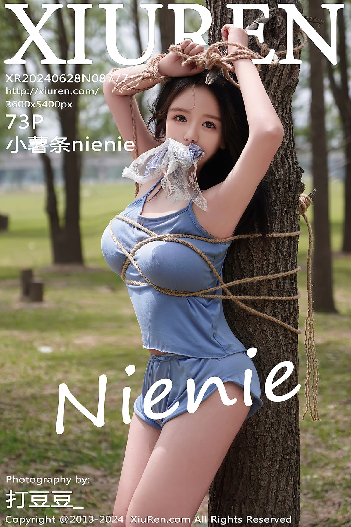 NO.8777小薯条nienie – [秀人网] - 柒美图